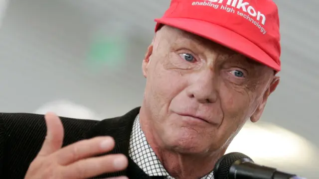 El propio Niki bromeaba sobre su accidente y sobre su aspecto tras el choque